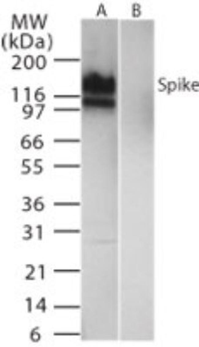 SARS Coronavirus Spike Protein Antibody in Western Blot (WB)