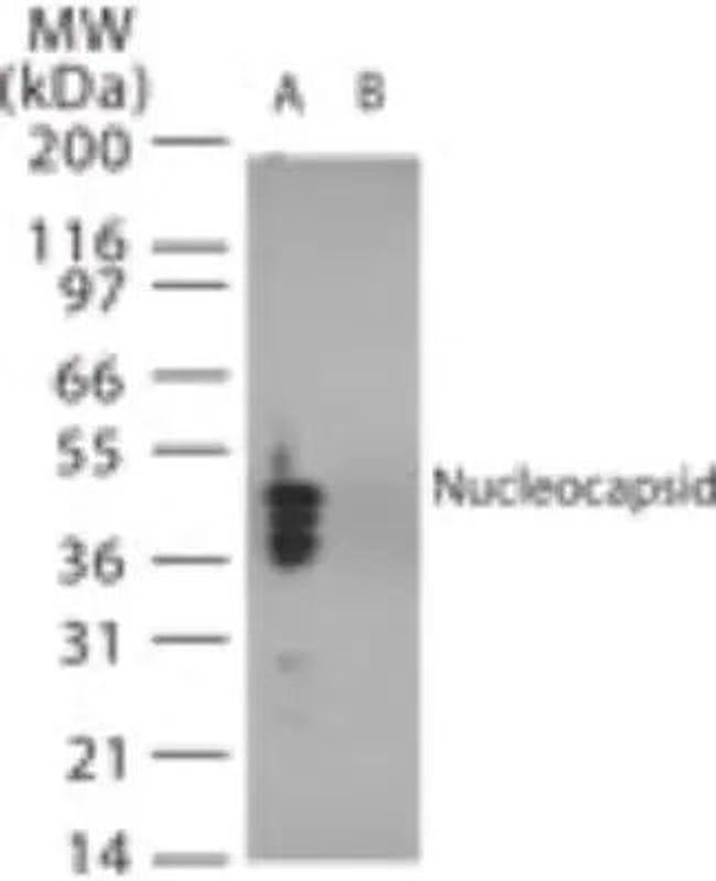 SARS Coronavirus Nucleocapsid Antibody in Western Blot (WB)