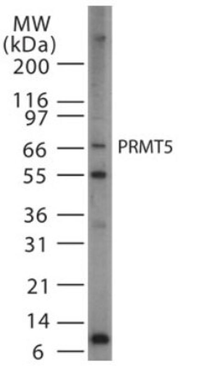 PRMT5 Antibody in Western Blot (WB)