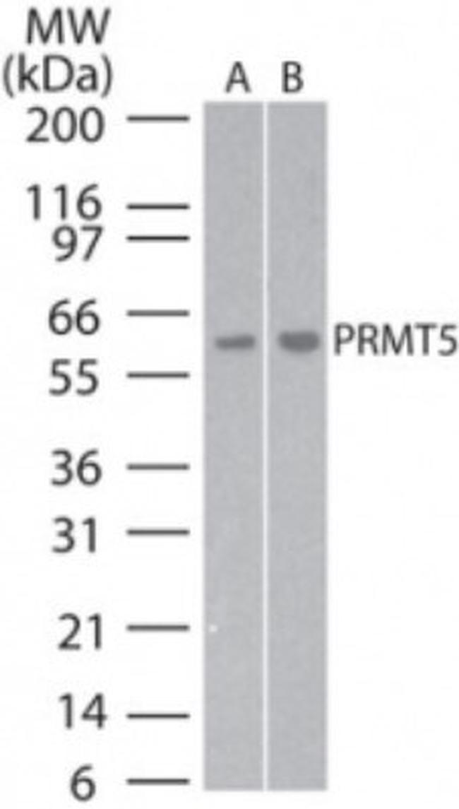 PRMT5 Antibody in Western Blot (WB)