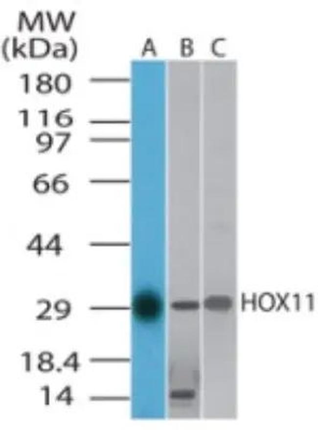 HOXA11 Antibody in Western Blot (WB)