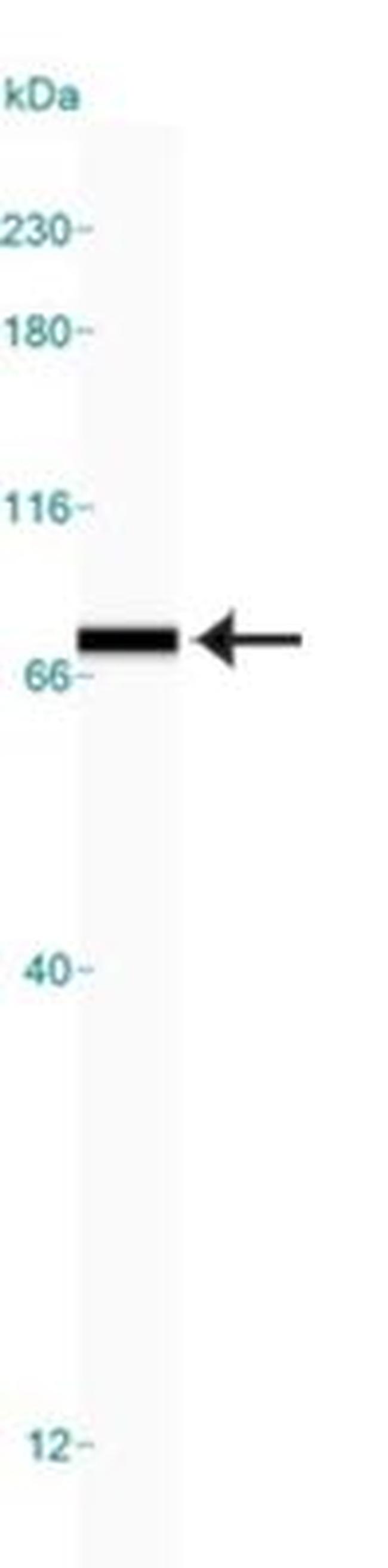 GRP78 Antibody in Western Blot (WB)