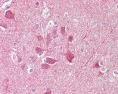 PGP9.5 Antibody in Immunohistochemistry (Paraffin) (IHC (P))