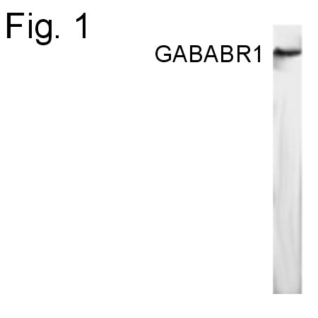 GABARAP Antibody in Western Blot (WB)