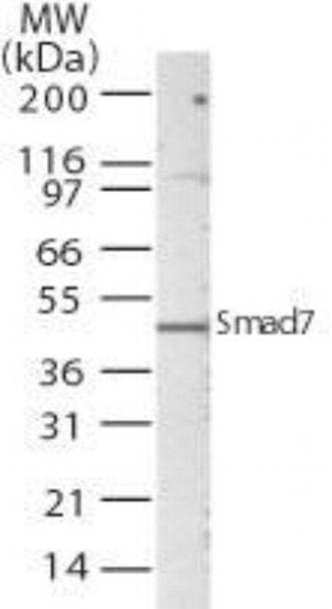 SMAD7 Antibody in Western Blot (WB)