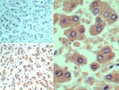 SMAD3 Antibody in Immunohistochemistry (Paraffin) (IHC (P))