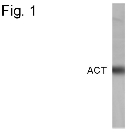 SERPINA3 Antibody in Western Blot (WB)