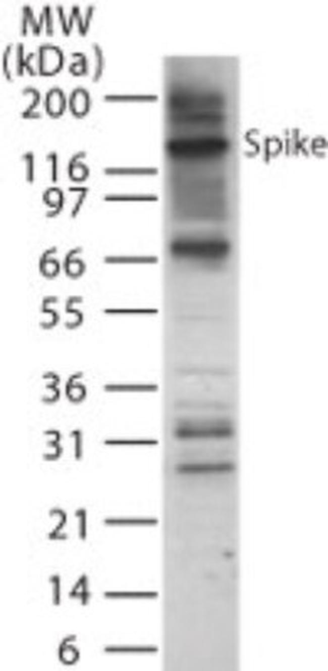 SARS Coronavirus Spike Protein Antibody in Western Blot (WB)