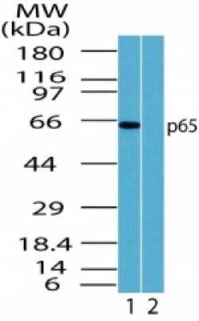 NFkB p65 Antibody in Western Blot (WB)