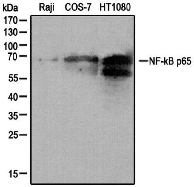 NFkB p65 Antibody in Western Blot (WB)