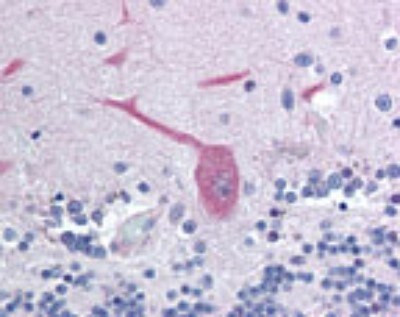 LFG Antibody in Immunohistochemistry (Paraffin) (IHC (P))