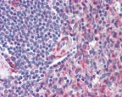 CD97 Antibody in Immunohistochemistry (Paraffin) (IHC (P))