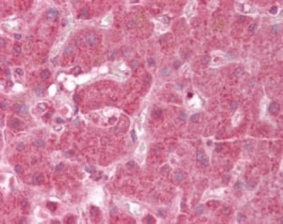 NDUFA13 Antibody in Immunohistochemistry (Paraffin) (IHC (P))