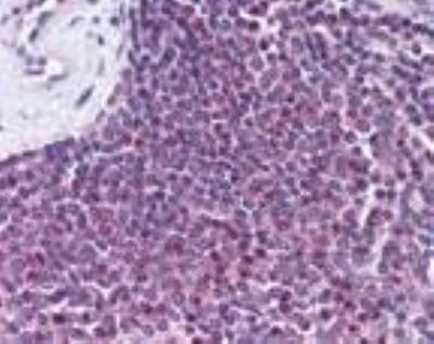 GPR109B Antibody in Immunohistochemistry (Paraffin) (IHC (P))