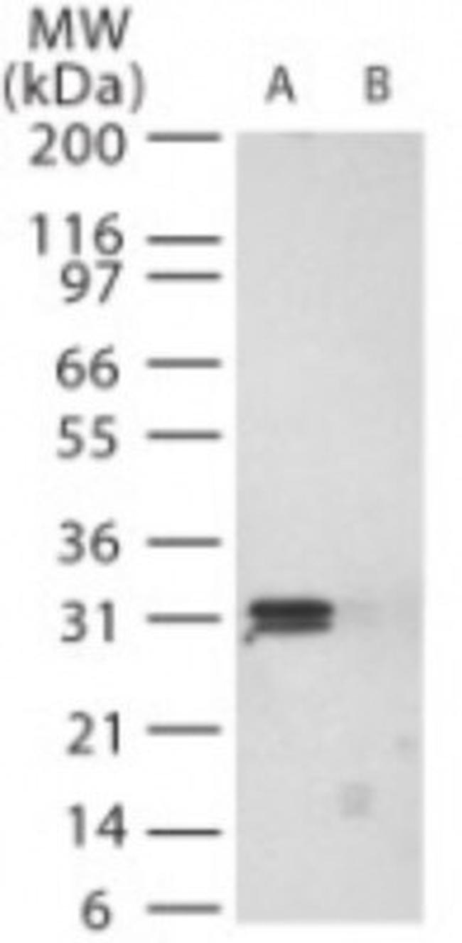 PrP Antibody in Western Blot (WB)