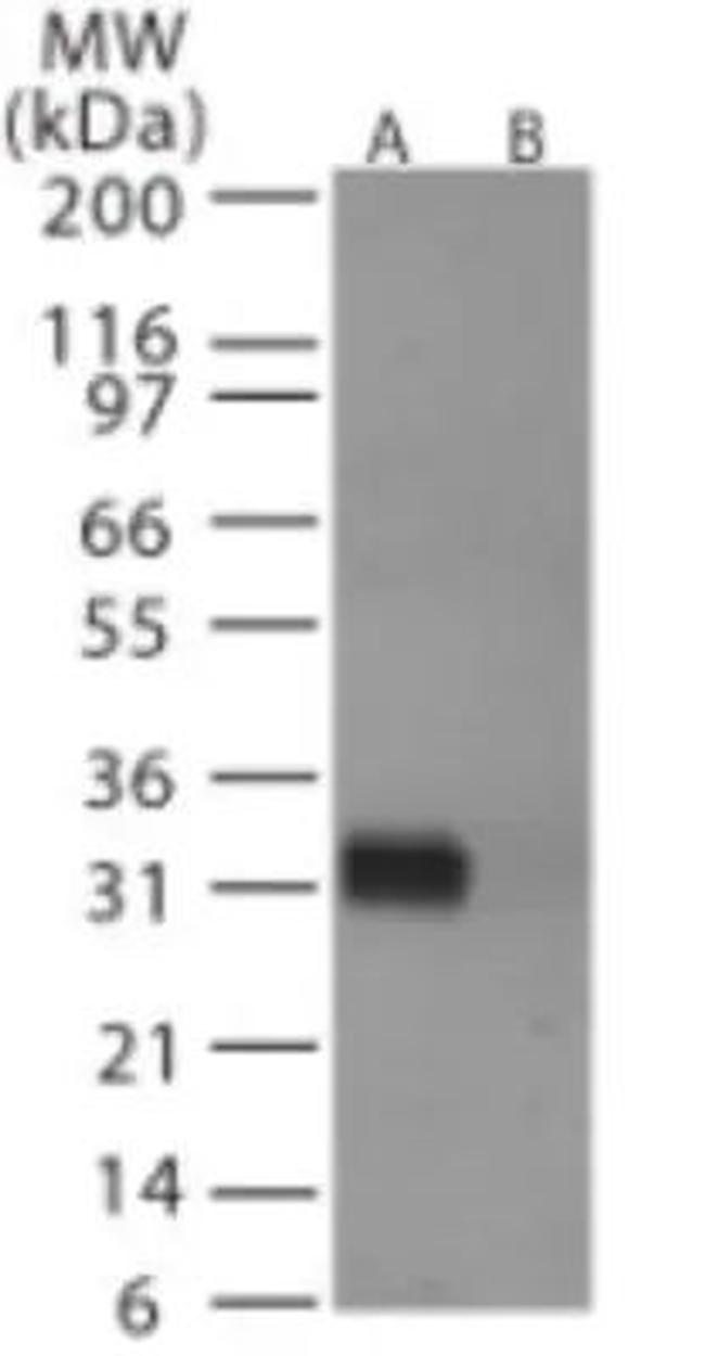 Influenza A H6N1 HA Antibody in Western Blot (WB)