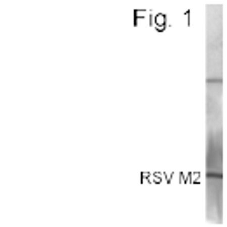 RSV M2 Antibody in Western Blot (WB)