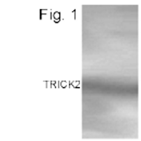 TRAIL-R2 (DR5) Antibody in Western Blot (WB)