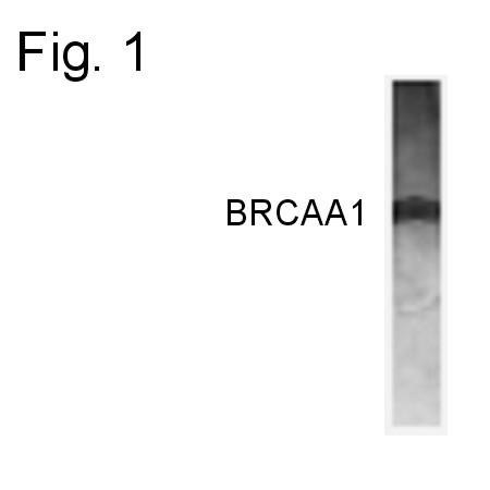 BRCAA1 Antibody in Western Blot (WB)