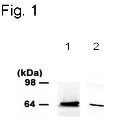 PINK1 Antibody in Western Blot (WB)