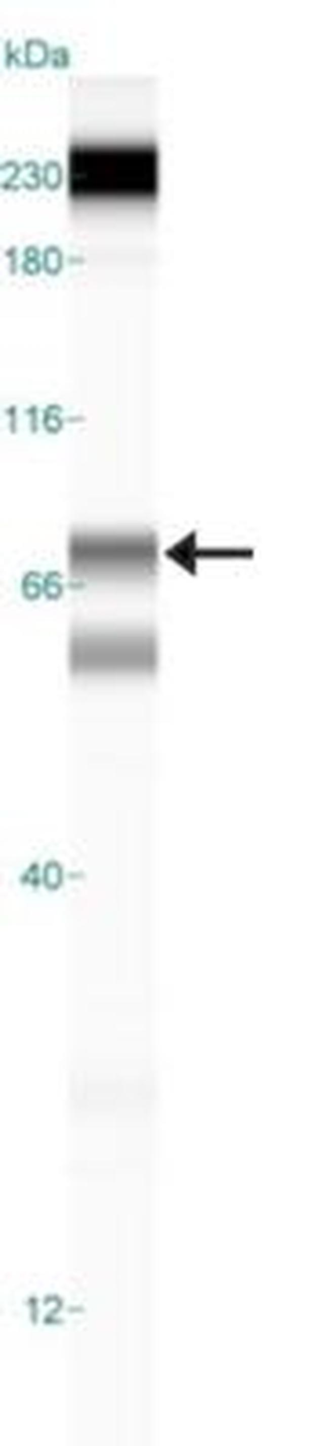 ALOX5 Antibody in Western Blot (WB)