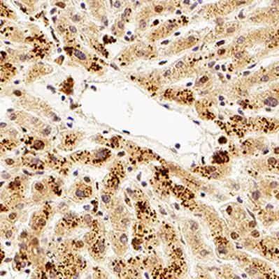 TMP21 Antibody in Immunohistochemistry (Paraffin) (IHC (P))