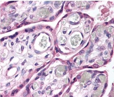 ROBO4 Antibody in Immunohistochemistry (Paraffin) (IHC (P))