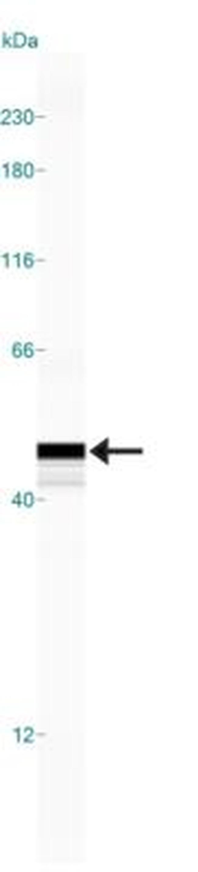 PTGDS Antibody in Western Blot (WB)