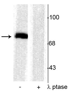Phospho-Synapsin 1 (Ser603) Antibody in Western Blot (WB)