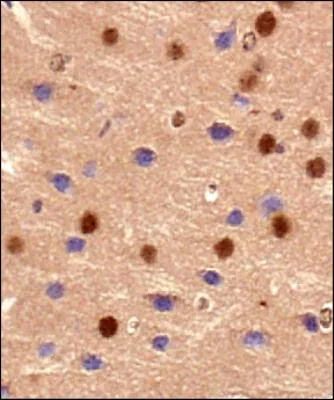 BMAL1 Antibody in Immunohistochemistry (Paraffin) (IHC (P))