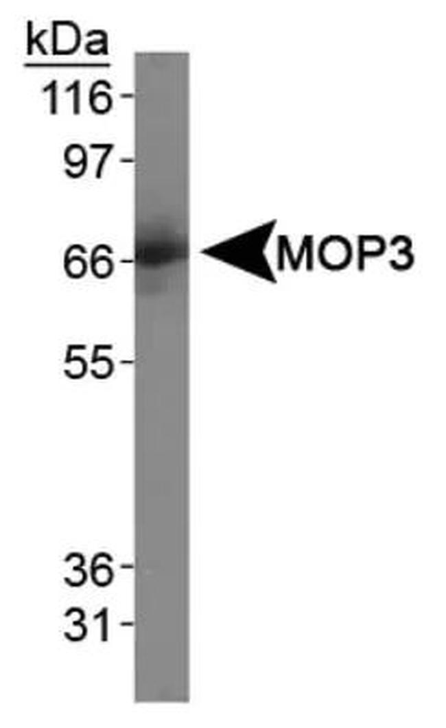 BMAL1 Antibody in Western Blot (WB)