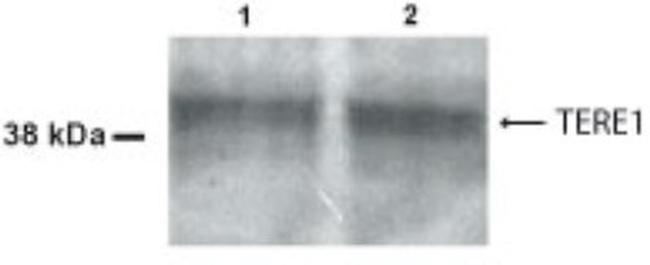 UBIAD1 Antibody in Western Blot (WB)