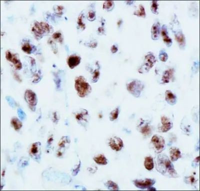 53BP1 Antibody in Immunohistochemistry (Paraffin) (IHC (P))