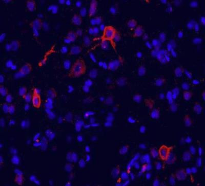 mGluR1 Antibody in Immunohistochemistry (Frozen) (IHC (F))