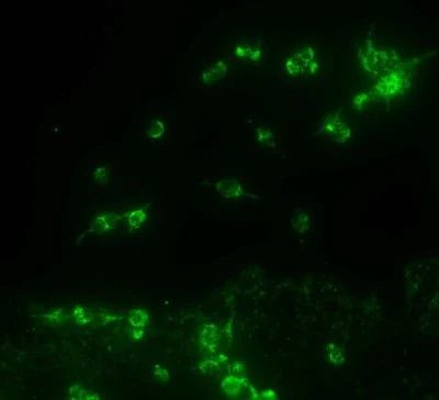 TRPA1 Antibody in Immunocytochemistry (ICC/IF)