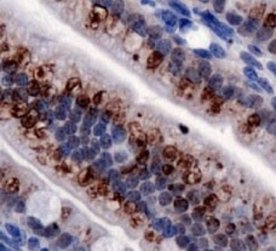 TRPA1 Antibody in Immunohistochemistry (Paraffin) (IHC (P))