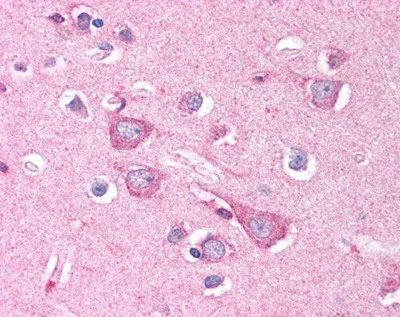 DISC1 Antibody in Immunohistochemistry (Paraffin) (IHC (P))