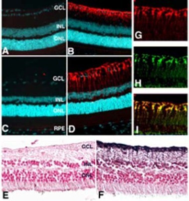 Glutamine Synthetase Antibody in Immunohistochemistry (Paraffin) (IHC (P))