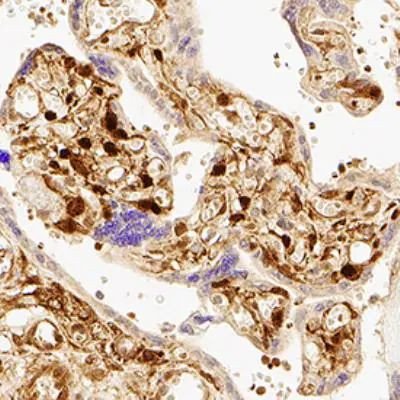 YAP1 Antibody in Immunohistochemistry (Paraffin) (IHC (P))