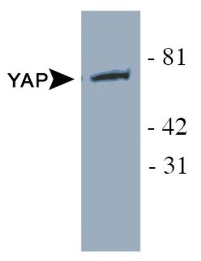 YAP1 Antibody in Western Blot (WB)