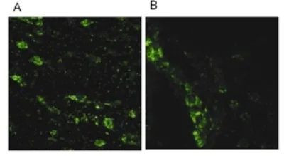 LRRK2 Antibody in Immunocytochemistry (ICC/IF)