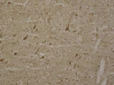 LRRK2 Antibody in Immunohistochemistry (Frozen) (IHC (F))