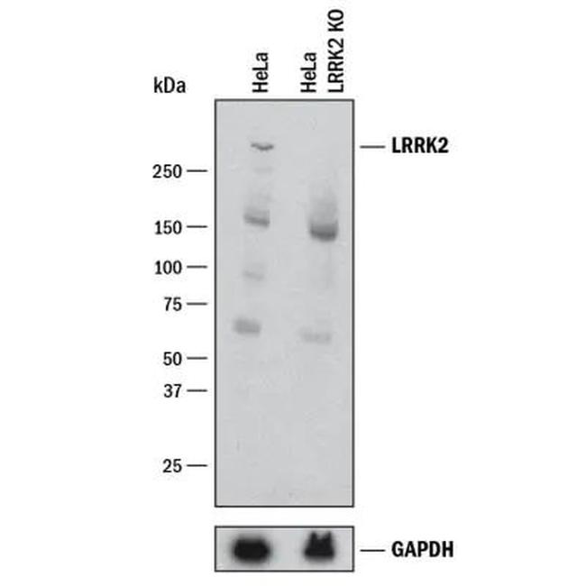 LRRK2 Antibody in Western Blot (WB)