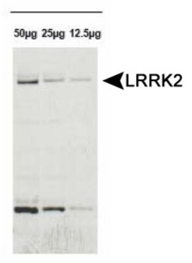 LRRK2 Antibody in Western Blot (WB)