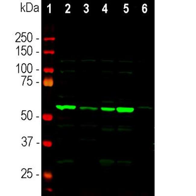 Coronin 1A Antibody in Western Blot (WB)