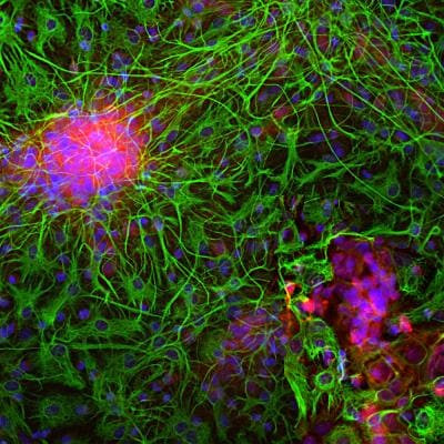 NSE Antibody in Immunocytochemistry (ICC/IF)