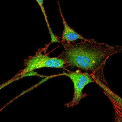 NSE Antibody in Immunocytochemistry (ICC/IF)