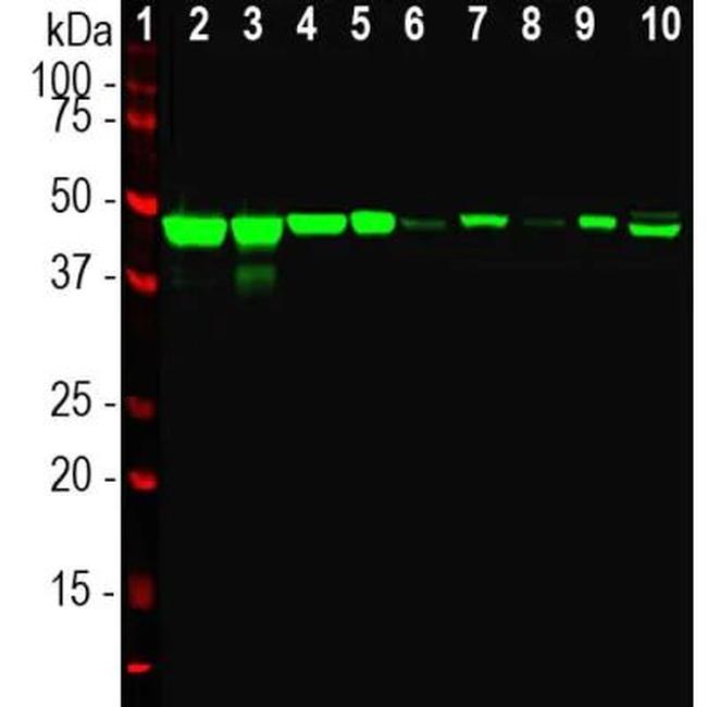 NSE Antibody in Western Blot (WB)