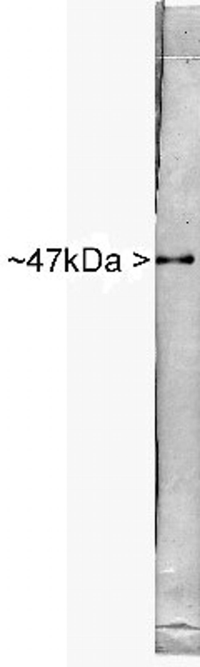 NSE Antibody in Western Blot (WB)