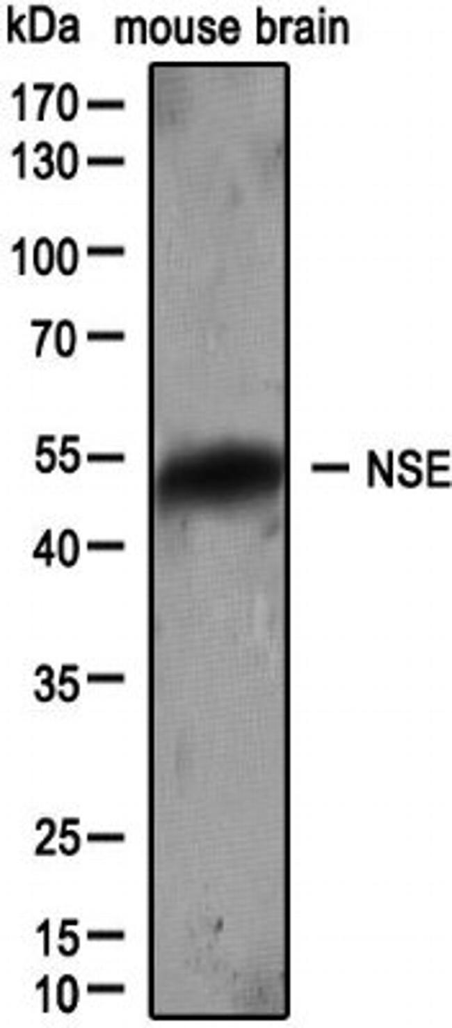 NSE Antibody in Western Blot (WB)